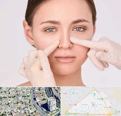 جراح راینوپلاستی در قاسم آباد مشهد