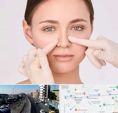 جراح راینوپلاستی در پیروزی