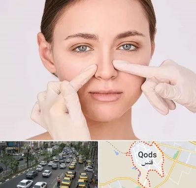 جراح راینوپلاستی در شهر قدس