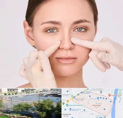 جراح راینوپلاستی در گلستان اهواز