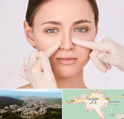 جراح راینوپلاستی در گرگان