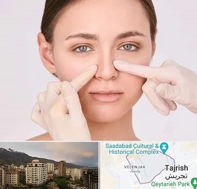 جراح راینوپلاستی در زعفرانیه