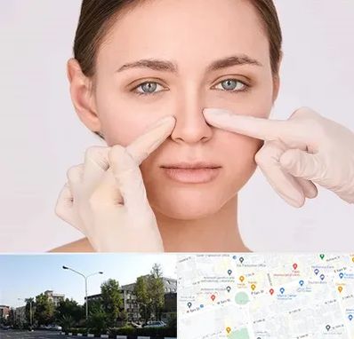 جراح راینوپلاستی در میدان کاج