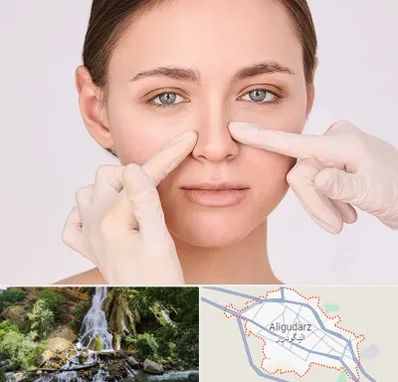 جراح راینوپلاستی در الیگودرز