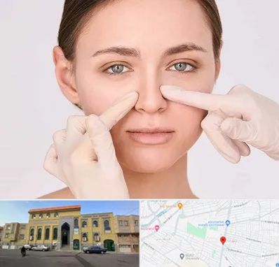 جراح راینوپلاستی در زنبیل آباد قم