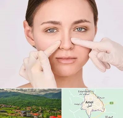 جراح راینوپلاستی در آمل