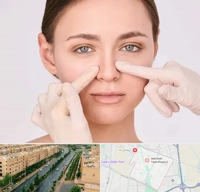 جراح راینوپلاستی در فاز سه اندیشه