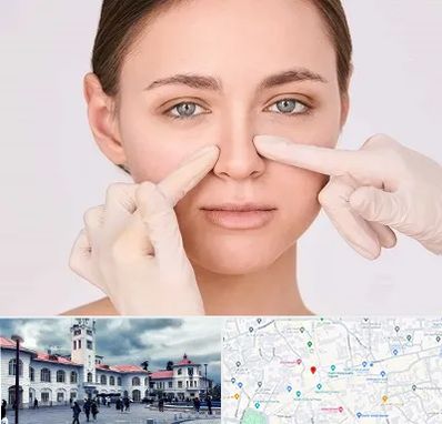 جراح راینوپلاستی در میدان شهرداری رشت