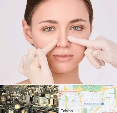 جراح راینوپلاستی در مرزداران