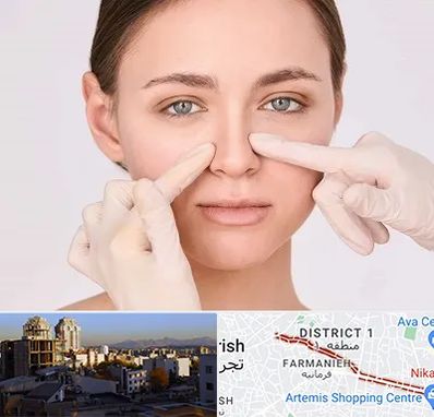 جراح راینوپلاستی در فرمانیه