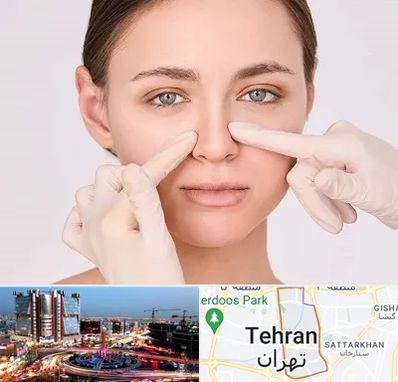 جراح راینوپلاستی در صادقیه