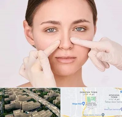 جراح راینوپلاستی در اکباتان