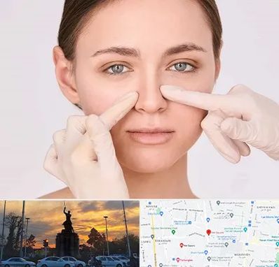 جراح راینوپلاستی در میدان حر