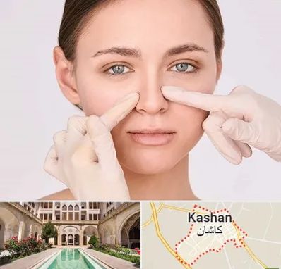 جراح راینوپلاستی در کاشان