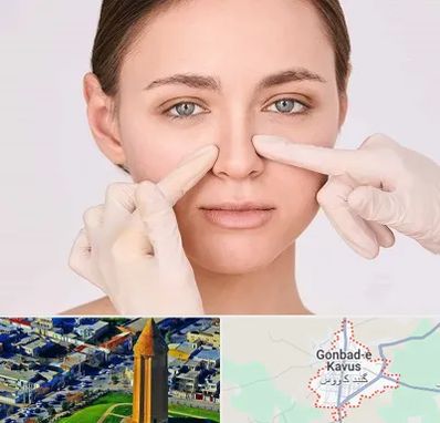 جراح راینوپلاستی در گنبد کاووس