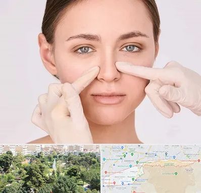 جراح راینوپلاستی در منطقه 13 تهران