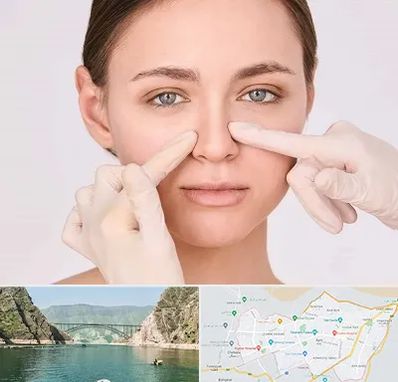 جراح راینوپلاستی در ایلام