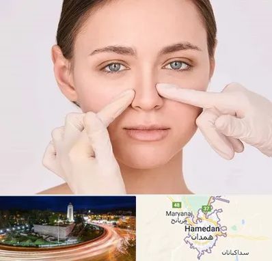 جراح راینوپلاستی در همدان