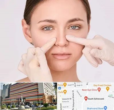 جراح راینوپلاستی در سهروردی