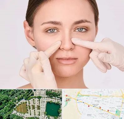 جراح راینوپلاستی در وکیل آباد مشهد