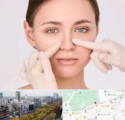 جراح راینوپلاستی در بلوار کشاورز