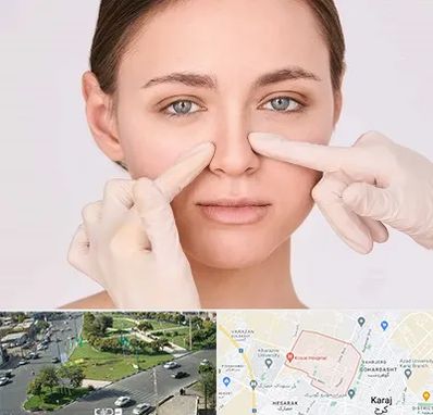 جراح راینوپلاستی در شاهین ویلا کرج