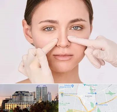 جراح راینوپلاستی در فرشته