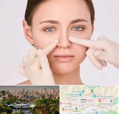 جراح راینوپلاستی در منطقه 1 تهران