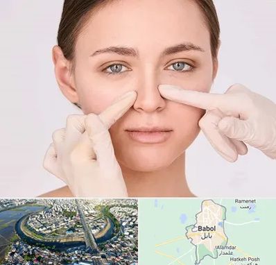 جراح راینوپلاستی در بابل