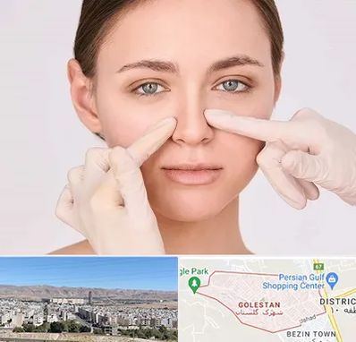 جراح راینوپلاستی در شهرک گلستان شیراز