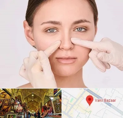 جراح راینوپلاستی در بازار وکیل شیراز