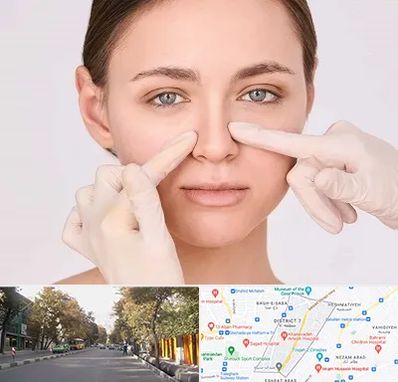 جراح راینوپلاستی در شریعتی