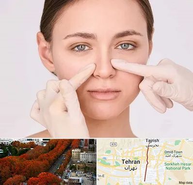 جراح راینوپلاستی در ولیعصر