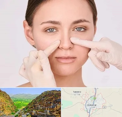 جراح راینوپلاستی در کامیاران