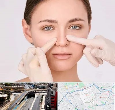 جراح راینوپلاستی در ستارخان شیراز