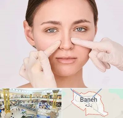 جراح راینوپلاستی در بانه