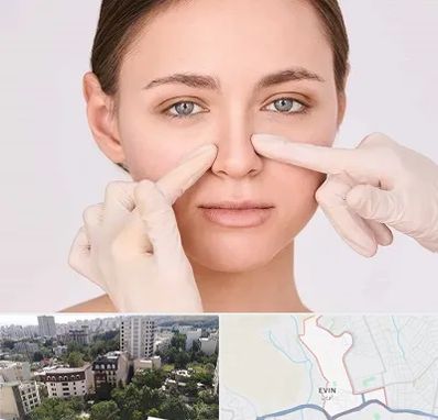 جراح راینوپلاستی در اوین