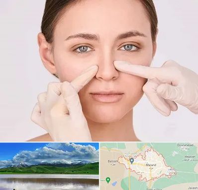 جراح راینوپلاستی در مرند