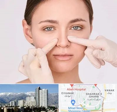 جراح راینوپلاستی در شهرک غرب
