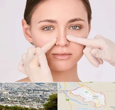 جراح راینوپلاستی در یاسوج