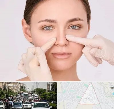 جراح راینوپلاستی در سیدی مشهد