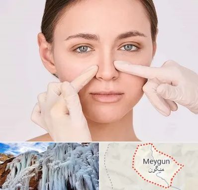 جراح راینوپلاستی در میگون