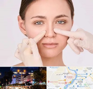 جراح راینوپلاستی در کیانپارس اهواز