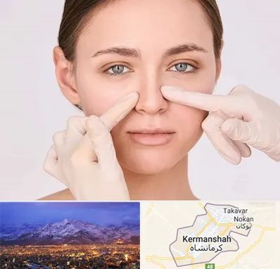 جراح راینوپلاستی در کرمانشاه