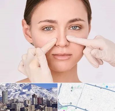 جراح راینوپلاستی در ازگل