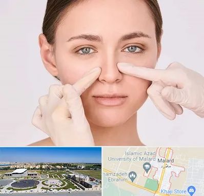 جراح راینوپلاستی در ملارد