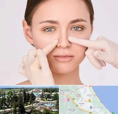 جراح راینوپلاستی در رودسر