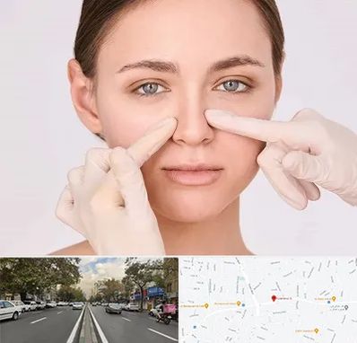 جراح راینوپلاستی در دولت