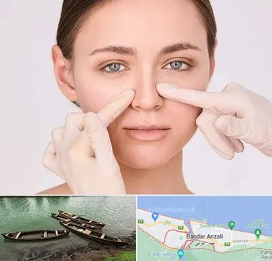 جراح راینوپلاستی در بندر انزلی