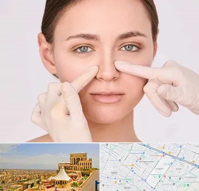 جراح راینوپلاستی در هاشمیه مشهد